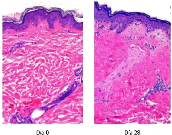 resulltados lasergen